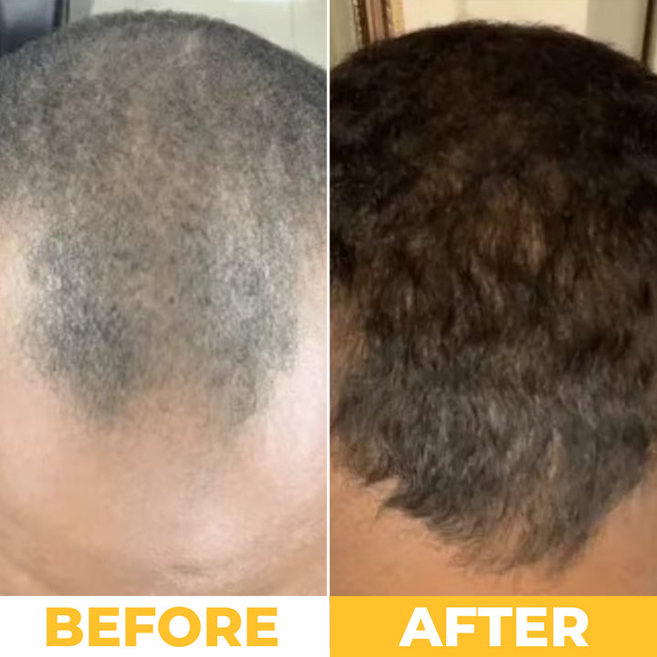 NoBald 3-in-1 Hair Growth Oil (Batana, Castor &amp; Rosemary)