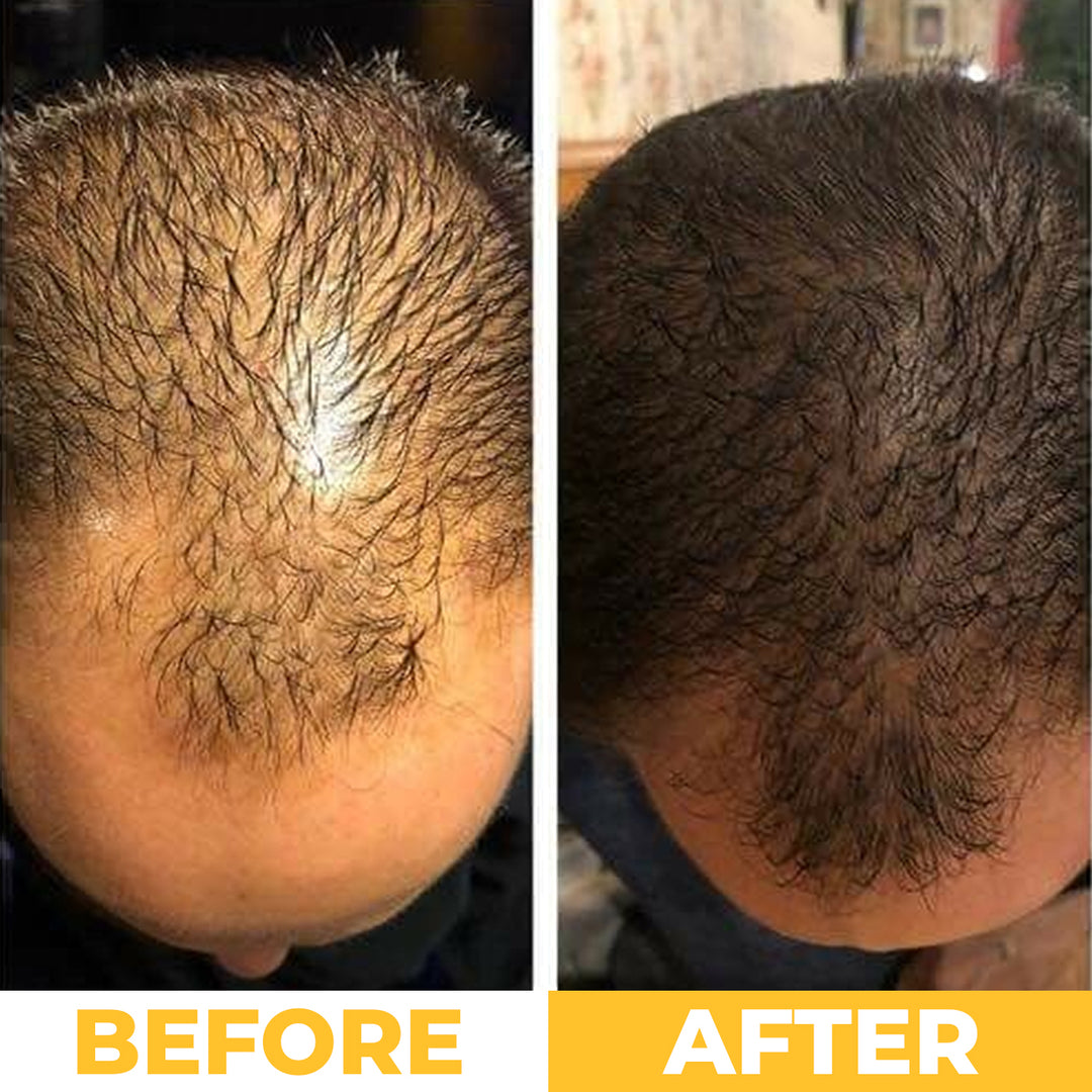 NoBald 3-in-1 Hair Growth Oil (Batana, Castor &amp; Rosemary)