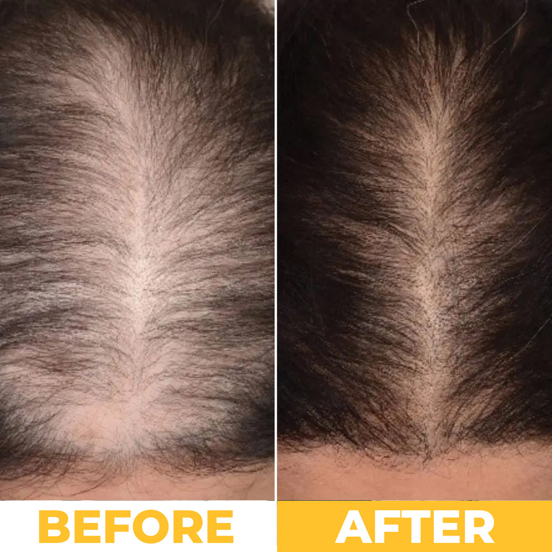 NoBald 3-in-1 Hair Growth Oil (Batana, Castor &amp; Rosemary)