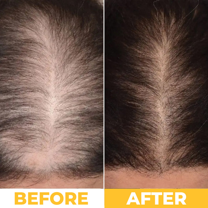 NoBald 3-in-1 Hair Growth Oil (Batana, Castor &amp; Rosemary)